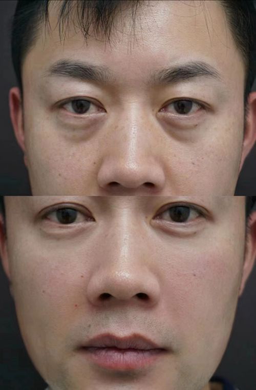 品哪款好深度测评前十国货护肤品AG凯发K8国际抗皱紧致护肤(图3)